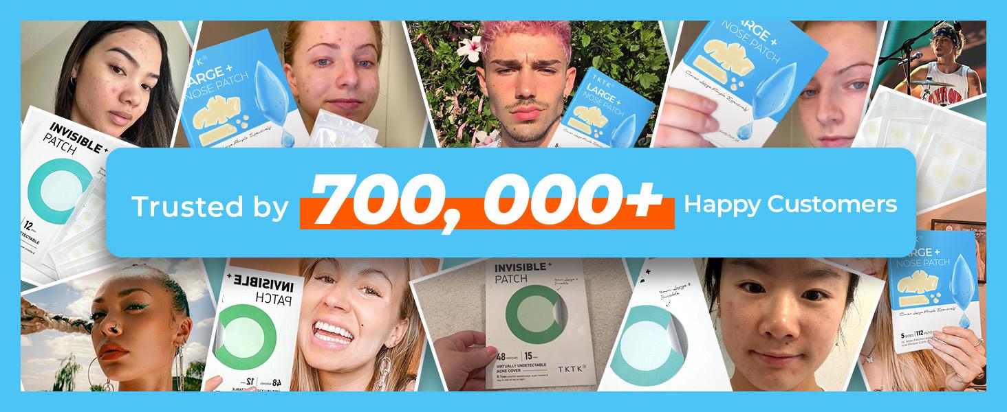 TKTK Hydrocolloid Nose Patches, XL Nose Pore Strips 91 x 48 mm, Large Hydrocolloid Acne Pimple Patches for Face, Cover Zit Blemishes & Absorb Oil (Nose Contoured, Strip, Dots 5 Sizes 112 Count) #mothersdaygift #Summervibes TKTK Hydrocolloid Nose Patches, XL Nose Pore Strips 91 x 48 mm, Large Hydrocolloid Acne Pimple Patches for Face, Cover Zit Blemishes & Absorb Oil (Nose Contoured, Strip, Dots 5 Sizes 112 Count) #mothersdaygift #Summervibes