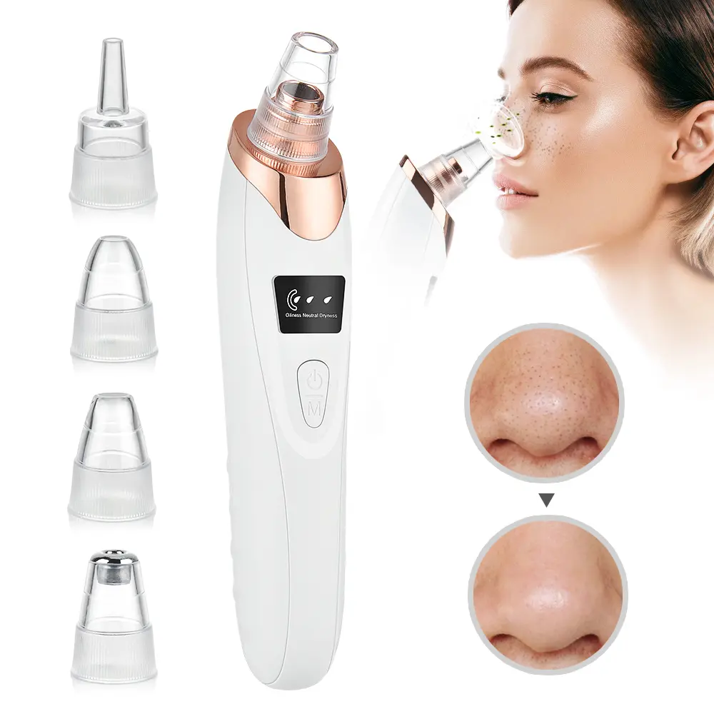 Blackhead Remover Pore Vacuum, USB Rechargeable Facial Cleansing Tool with 4 Extractor Tips for Effective Pore Cleaning, Rechargeable Battery