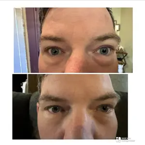 Product Review of Peter Thomas Roth Instant FirmX Easy Wear Temporary Eye Tightener (20ml) from D**e I** T** D**p G**t