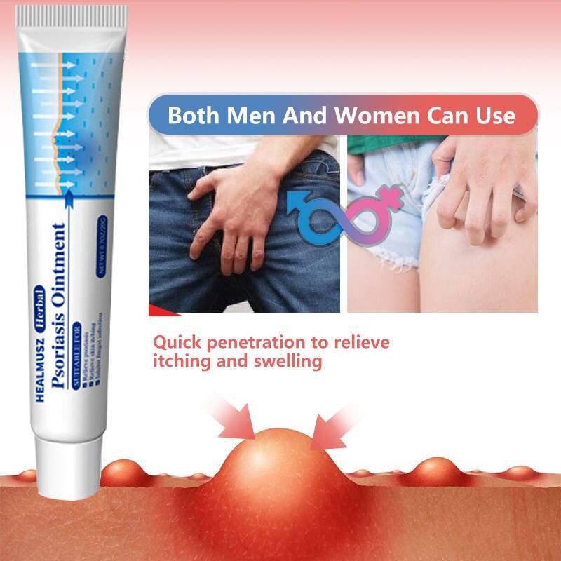 Antifungal & Psoriasis Cream – 100% Natural Plant Formula – Clinically Proven Fast Relief for Itching, Dryness, Redness & Flaking – Treats Psoriasis, Ringworm, Jock Itch, Athlete’s Foot – Deep Hydration, Skin Repair, Prevents Recurrence – 20g