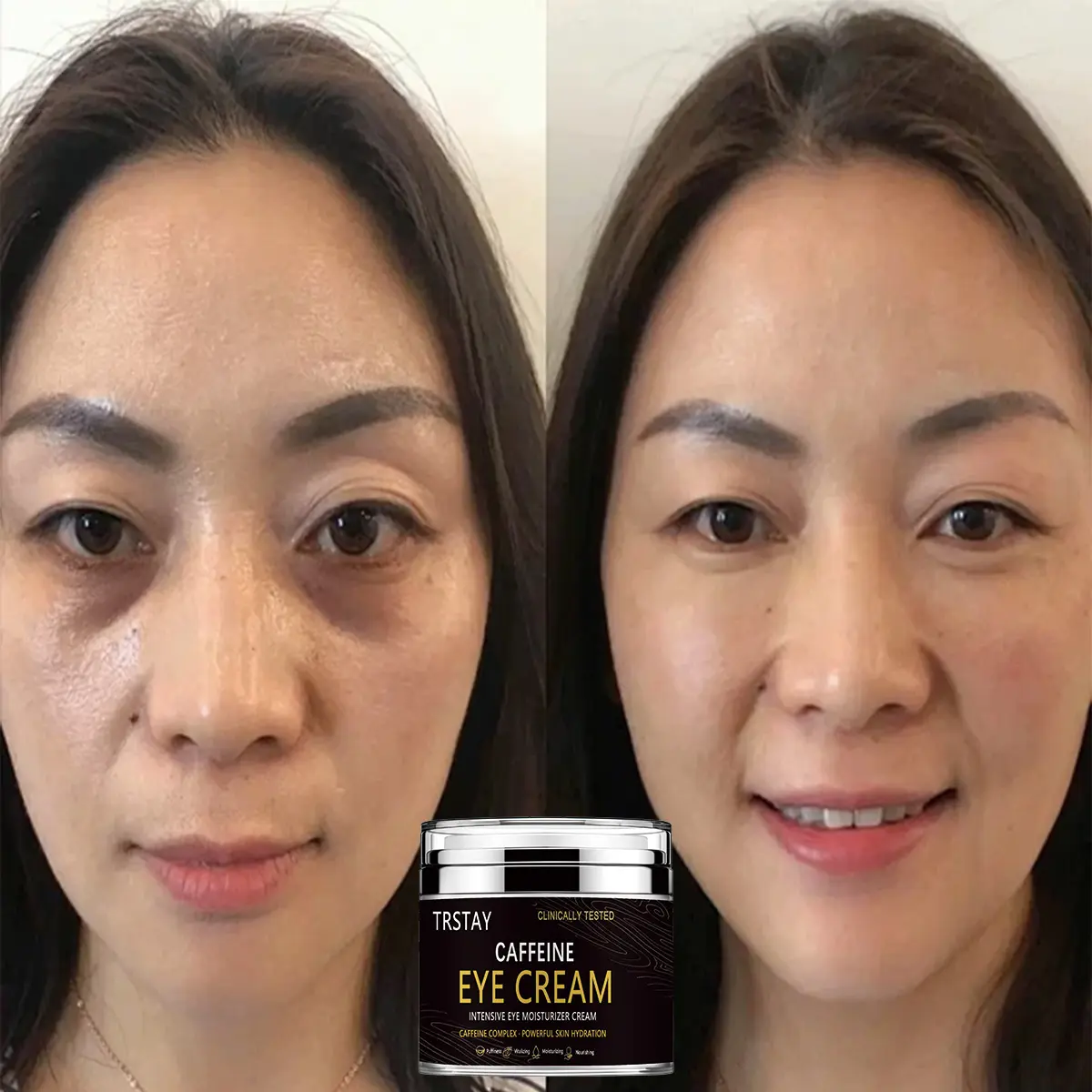 TRSTAY Caffeine Eye Cream effectively moisturizes and nourishes the skin, reducing the appearance of fine lines