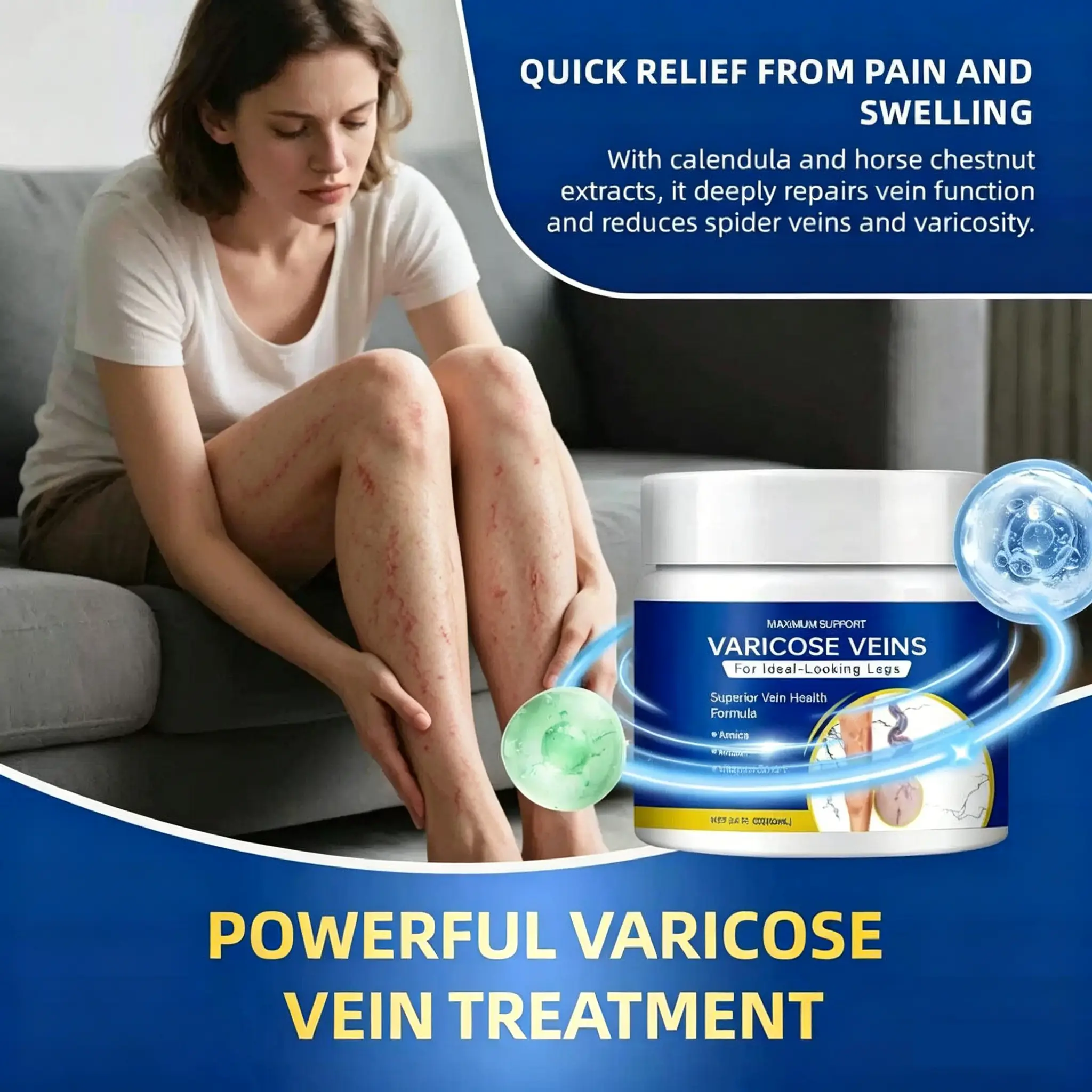 Varicose Vein Cream Quickly Relieves Varicose Vein Leg Blood Vessel Swelling Relief Herbal Spider Vein Fatigue Removal Double Legs Vein Cream Safe for Home Use