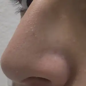 Product Review of [Dr.Melaxin Official] Peel Shot Glow Rice Ampoule Duo - Serums for Brightening, Exfoliating, and Moisturizing - Suitable for All Skin Types from J**7