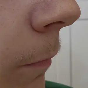 Product Review of [Dr.Melaxin Official] Peel Shot Glow Rice Ampoule Duo - Serums for Brightening, Exfoliating, and Moisturizing - Suitable for All Skin Types from s**h