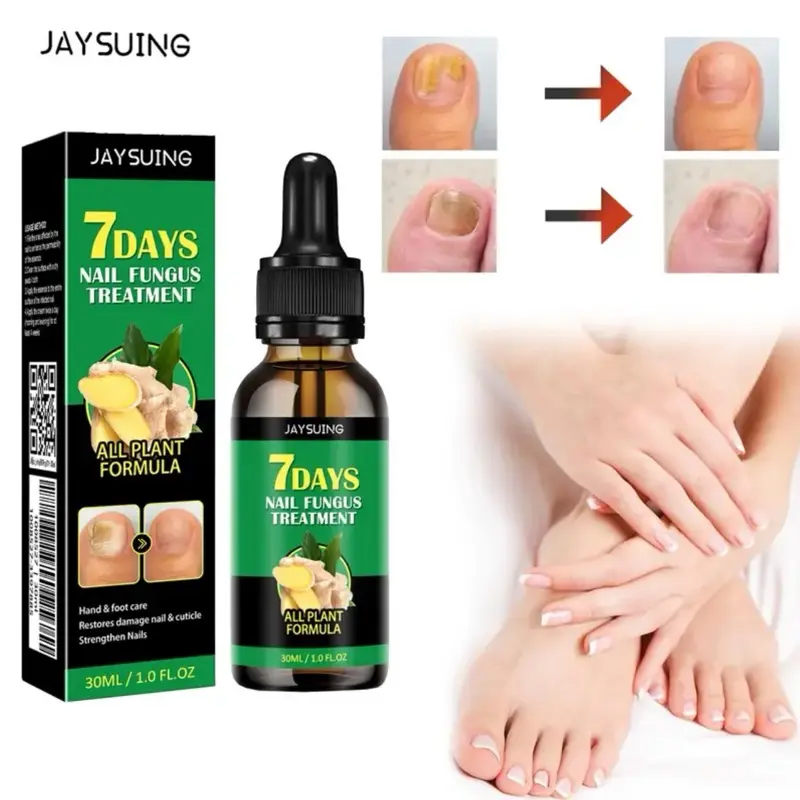 JAYSUING Ginger Nail Cuticle Care Serum - 30ml for Comfort and Manicure with Natural Formula