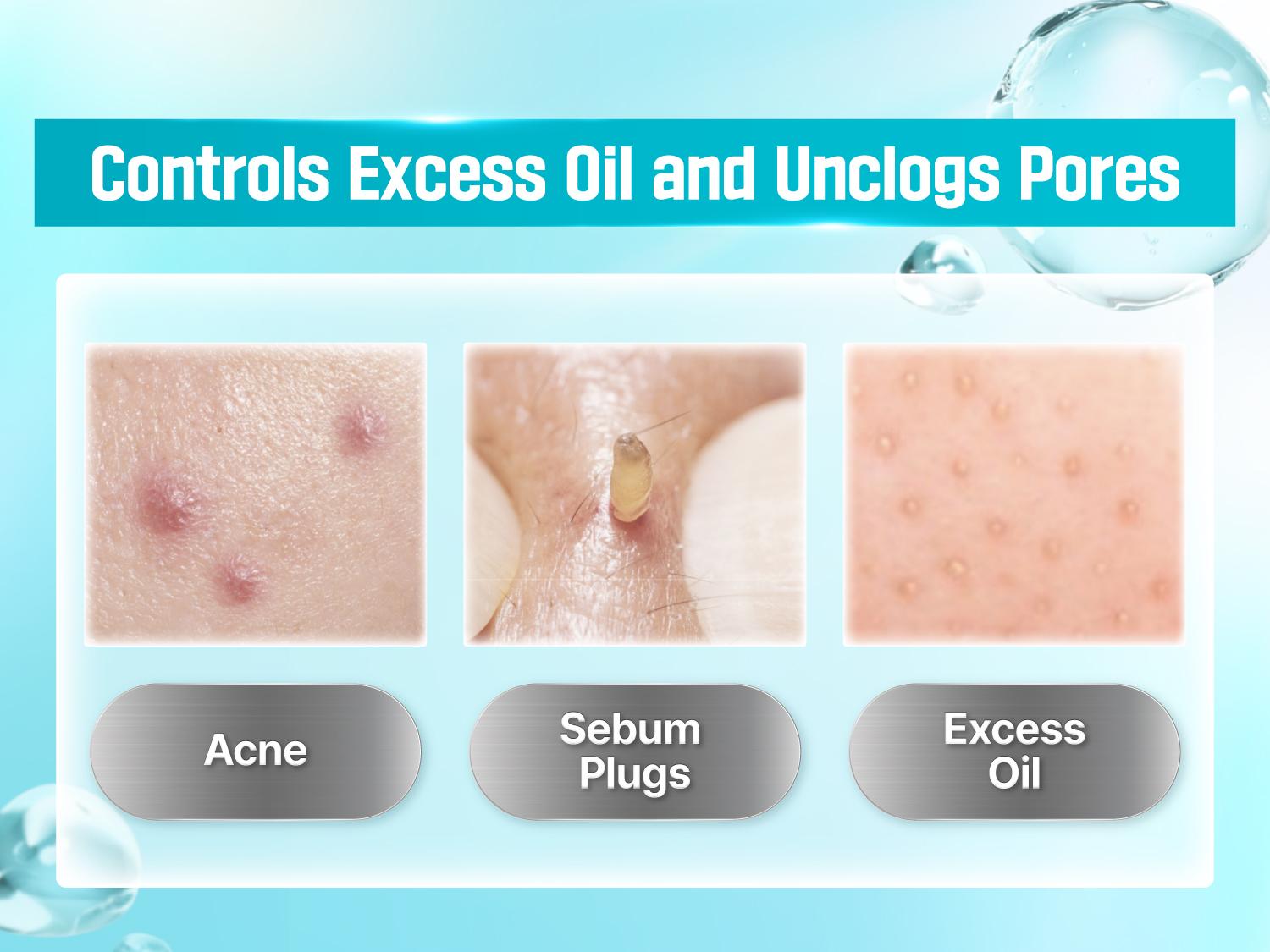 [numbuzin official shop] No.1 Acne Pantotenic Acid Set | No.1 Serum + Cream + Toner Pads + Powder