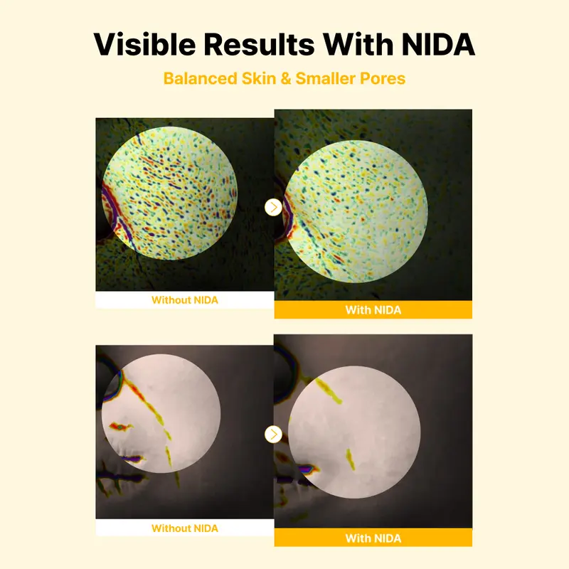 NIDA Peptide Propolis Renewal Serum Wrinkles Fine Lines Aging Skin Daily Radiant
