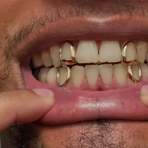 4pcs Gold Grillz Set, Hip Hop Style Copper Teeth Covers for Men & Women, Ideal Gift for Daily Wear.