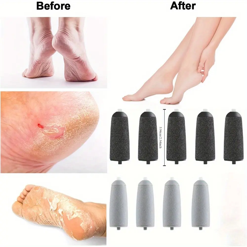 9Pcs/Set Replacing Grinding Wheel Heads Including 5 Black Coarse Sand and 4 Light Gray Replacement Sanding Heads for Removing Foot Skin,Dead Skin,Scabs,And Hard Skin Manicure Nail