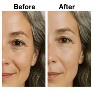 Ultimate Cloud Retinol + Vitamin C + Peptide Eye Concentrate