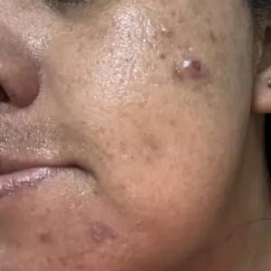 NIDA YouthfulFormula Cream and Revive Cream Bundle Elastic Skin Moisturize Daily Radiant Skin