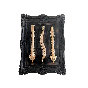 Beauty of Spines - Gothic Spine Wall Art in Ornate Black Frame