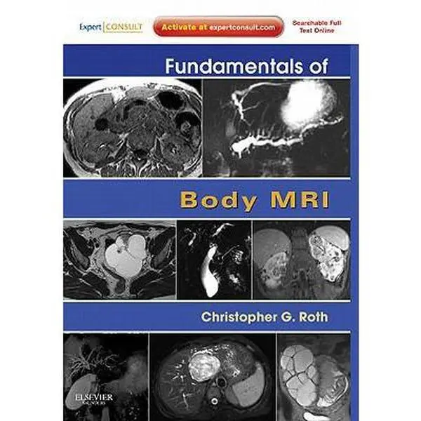 USED Book - Fundamentals of Body MRI: Expert Consult- Online and Print (Fundamentals of Radiology) by Christopher G. Roth MD (Paperback) - english