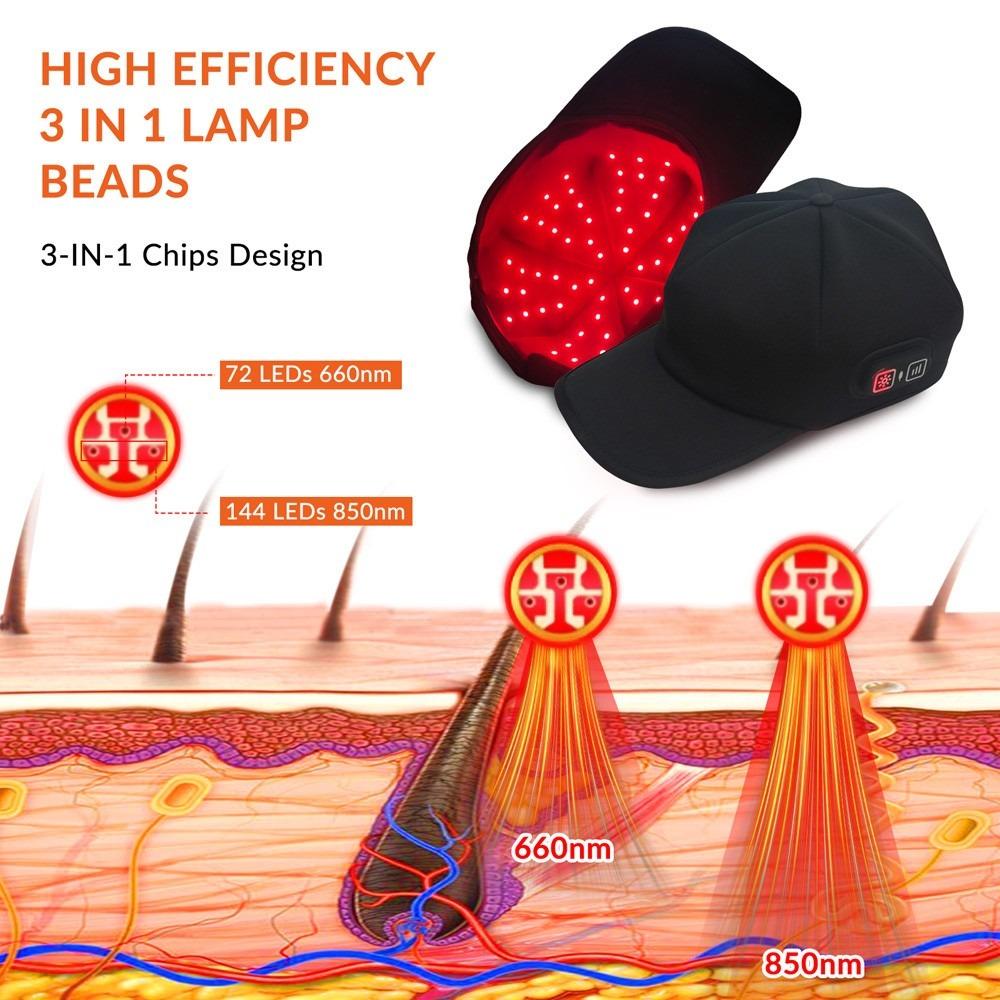 Red Light Therapy Cap for Hair Regrowth, 660nm (72 LEDs) & 850nm (144 LEDs) Near Infrared Phototherapy Hat & Hair Bonnet, Reduce Hair Loss, Protect Scalp, Repair Follicles, Anti-Thinning, Adjustable Pulse Modes, Hands-Free Home Use Festival Gift Red Light Therapy Cap for Hair Regrowth, 660nm (72 LEDs) & 850nm (144 LEDs) Near Infrared Phototherapy Hat & Hair Bonnet, Reduce Hair Loss, Protect Scalp, Repair Follicles, Anti-Thinning, Adjustable Pulse Modes, Hands-Free Home Use Festival Gift