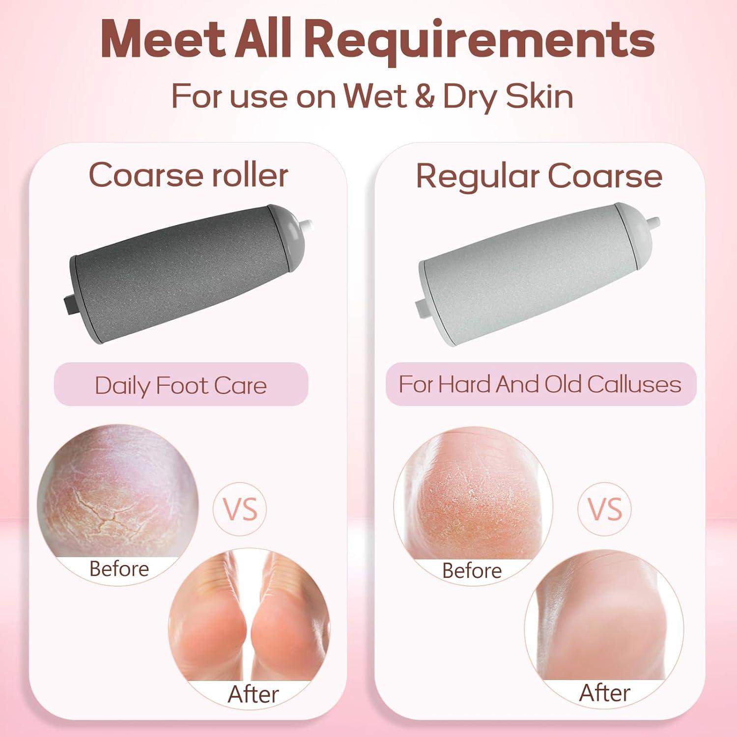 Rechargeable Portable Electric Foot Smoother - Waterproof Sand Roller Heads, ABS, Travel Size, Lightweight Pedicure Tool for Adults' Rough Dry Skin & Cracked Heels, Callus Shaver for Feet, Ideal Daily Care Gift (White) Rechargeable Portable Electric Foot Smoother - Waterproof Sand Roller Heads, ABS, Travel Size, Lightweight Pedicure Tool for Adults' Rough Dry Skin & Cracked Heels, Callus Shaver for Feet, Ideal Daily Care Gift (White)
