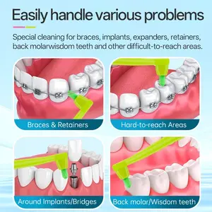 360° Replaceable Head Orthodontic Toothbrush, Soft Bristles Single Bundle, Ideal for Braces, Retainers, and Implant Care