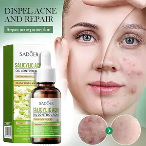 SADÖER Face Salicylic Acid Oil 25g - Acne Prone Treatment for Acne Reduction, Improved Skin Texture & Maintenance of Skin Cleanliness Moisturizing Gentle Pack Skincare Smoothing Cleanser Pore Moisture