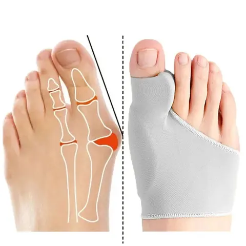 Foot Toe Separator, Bunion Corrector, Hallux Valgus Correction, Orthopedic Orthotics Shoe Insoles, Comfortable Footwear Inserts, Perfect Fit for Daily Wear & Special Occasions, Pedicure Foot Tool, Foot Care Tool