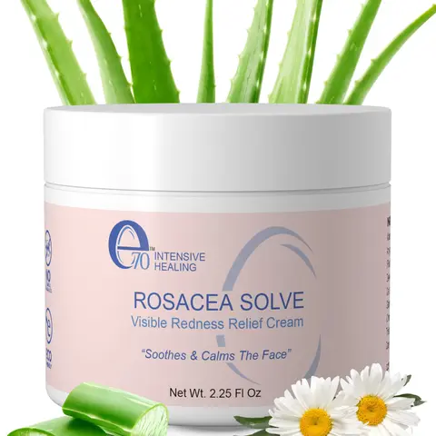 e70 Rosacea Solve Face Moisturizer - Redness Relief Cream w/ Aloe Vera & Hyaluronic Acid - Soothes, Hydrates & Calms Sensitive Skin (2.25 fl oz)- Available in Single & 2-Pack Options!