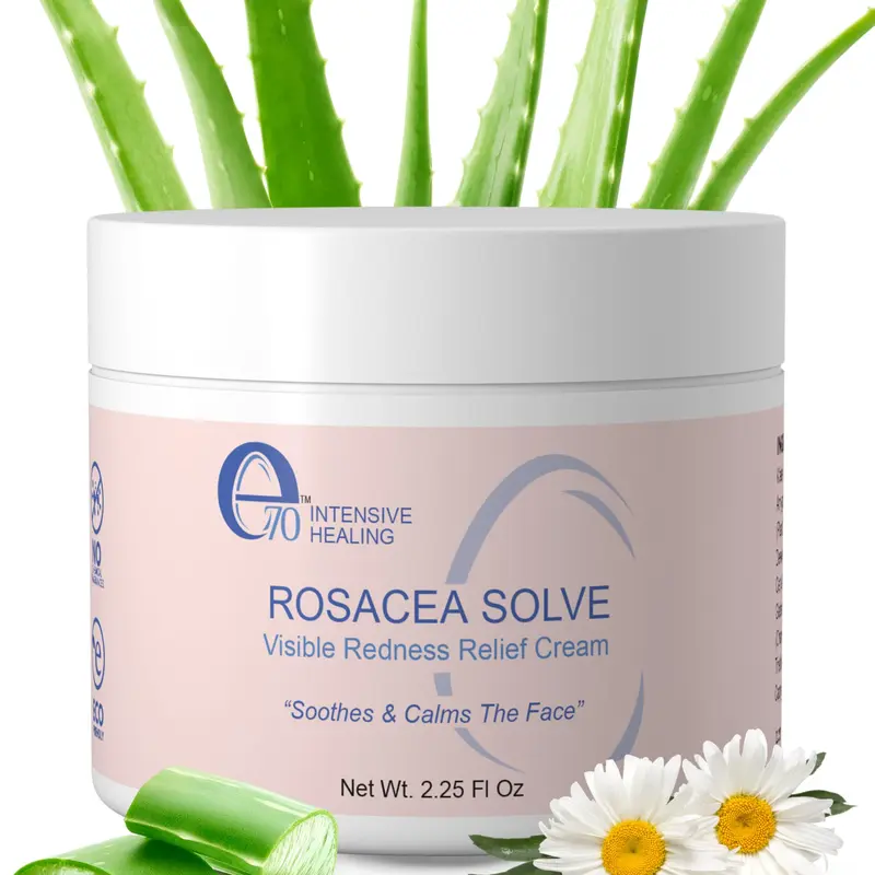 e70 Rosacea Solve Face Moisturizer - Redness Relief Cream w/ Aloe Vera & Hyaluronic Acid - Soothes, Hydrates & Calms Sensitive Skin (2.25 fl oz)- Available in Single & 2-Pack Options!