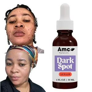 AMC Naturals Dark Spot Corrector Serum, Brightening Clarifying with Collagen, Jojoba Oil, Banana, Anti-aging Smoothing Serum 1oz