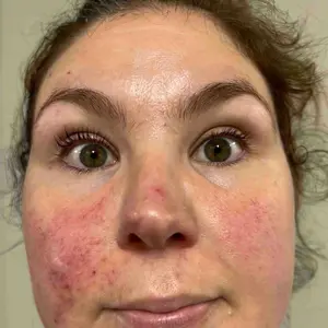 Product Review of [medicube] Affordable Glass Glow Skincare Set | Includes 8 products for Gentle Skin Glow Routine from M**a