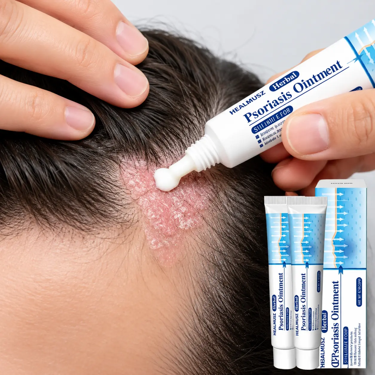 Powerful Antifungal Psoriasis Cream All Natural Formula for Itching Redness Dry Skin Relief Works on Eczema Tinea Jock Itch Scalp Fungus Ringworm Quick Action Deep Hydration