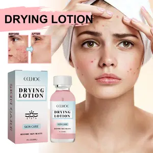 Salicylic Acid Facial Lotion (30ML/30ML X 4), Natural Ingredients, Reduces Acne & Pimples, Moisturizes Skin, Fines Pores, Pore Care Lotion