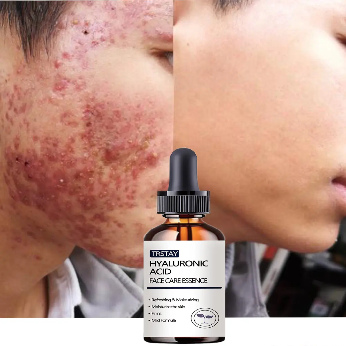 Men's Hydrating Serum – Enriched with hyaluronic acid and specially formulated for dry skin; leaves skin feeling smooth and refreshed without a greasy residue. Suitable for daily facial skincare. Hydrator Serum