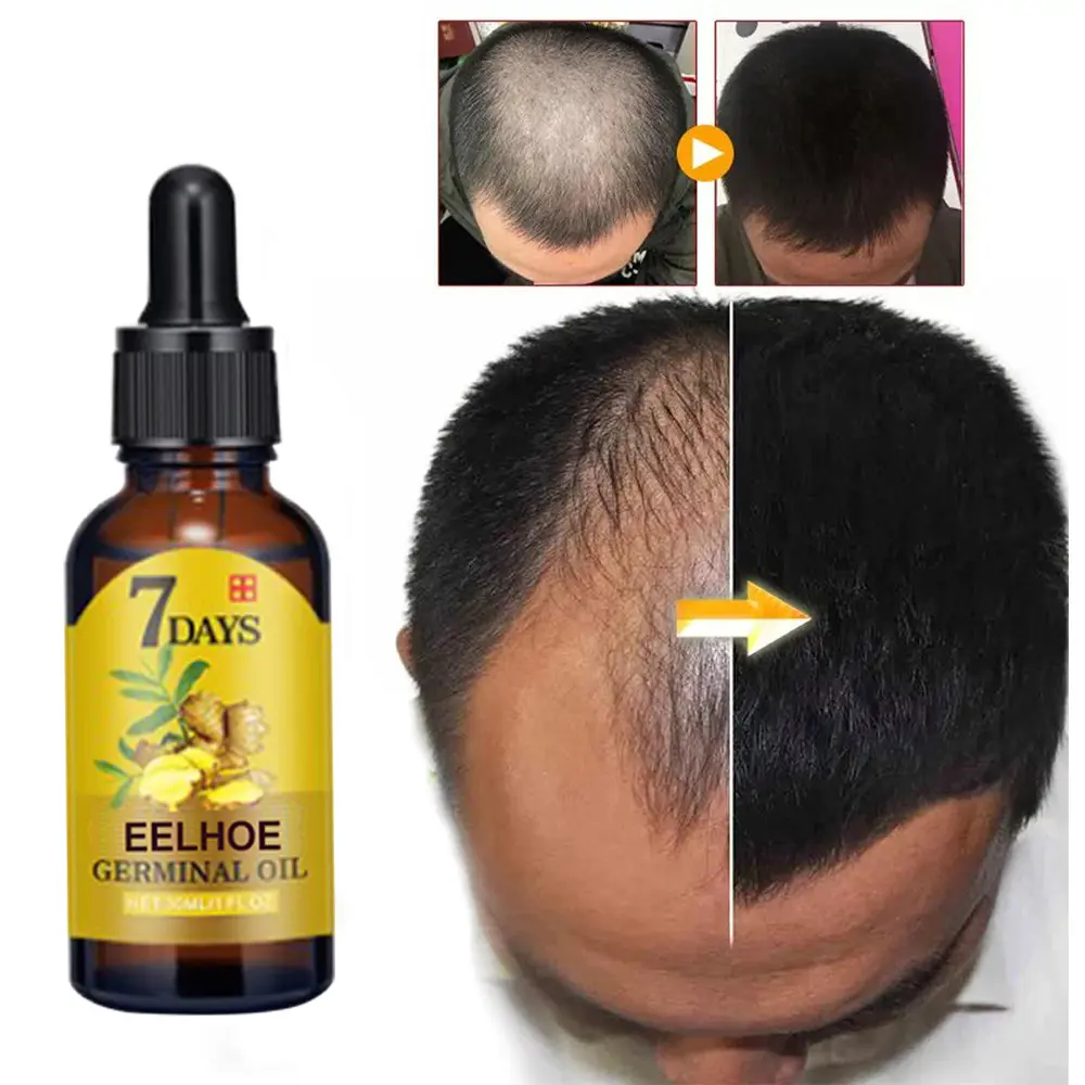 7 Day Fast Hair Growth Oil Ginger Growth Hair Treatment Anti Hair Loss Men Women Scalp Treatment Serum Products Beauty Product Haircare Plant - 40ml