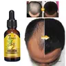 7 Day Fast Hair Growth Oil Ginger Growth Hair Treatment Anti Hair Loss Men Women Scalp Treatment Serum Products Beauty Product Haircare Plant - 40ml, Hair Restore, Scalp Revitalizing Solution, Fast Growth
