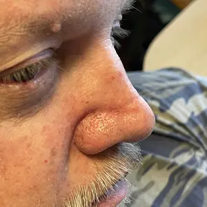 Product Review of [Dr.Melaxin Official] Peel Shot Glow Rice Ampoule Duo - Serums for Brightening, Exfoliating, and Moisturizing - Suitable for All Skin Types from j**7