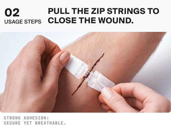 SURVIVEX Wound Closure Kit - Non-Invasive Skin Healing Solution for Cuts & Wounds - Gentle, Adjustable Tension, No Scarring, Easy Removal - All-in-One Emergency Healthcare Aid