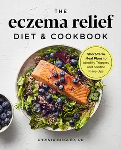 The Eczema Relief Diet & Cookbook: Short-Term Meal Plans to Identify Triggers and Soothe Flare-Ups -- Christa Biegler - Paperback