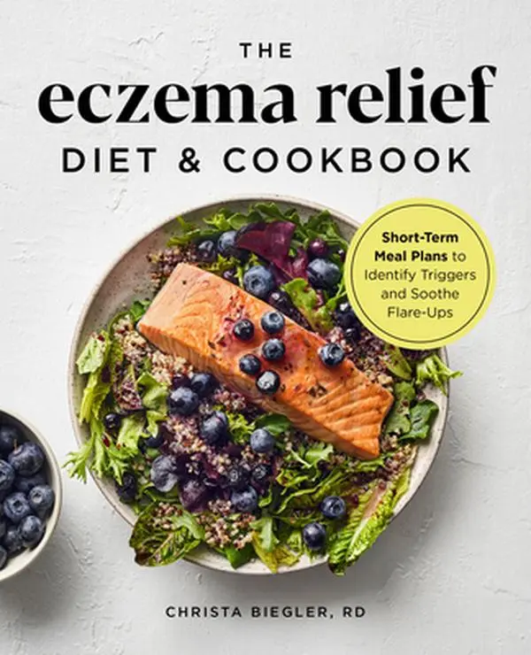 The Eczema Relief Diet & Cookbook: Short-Term Meal Plans to Identify Triggers and Soothe Flare-Ups -- Christa Biegler - Paperback