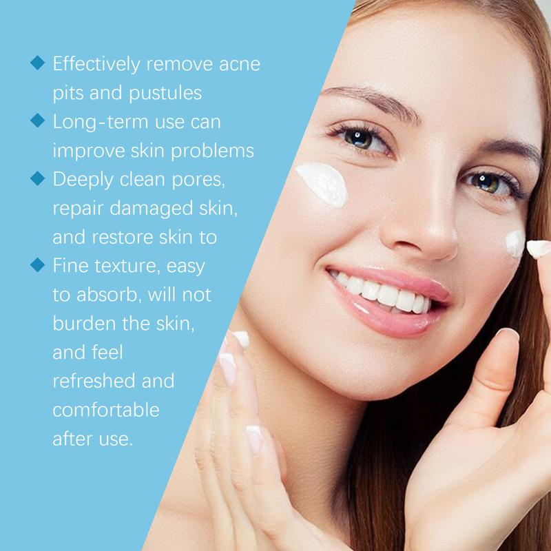 SOUTH MOON Skin Cream Helps Remove And Improve Skin Blemishes Gentle And Comfortable Controls Oil Secretion