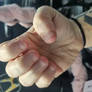 Product Review of Radiant Cosmetics Nail Growth Oil - 100% Organic, Moisturizing, Growth, Strengthening, and Brightening Formula with Vitamins and Fatty Acids for Overall Nail Health from u**6