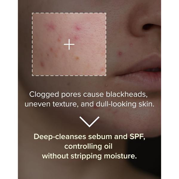 3W8L Deep Off & Fresh Cleansing Oil, Korean Pore Care Makeup & Sunscreen Remover with Jojoba & Centella