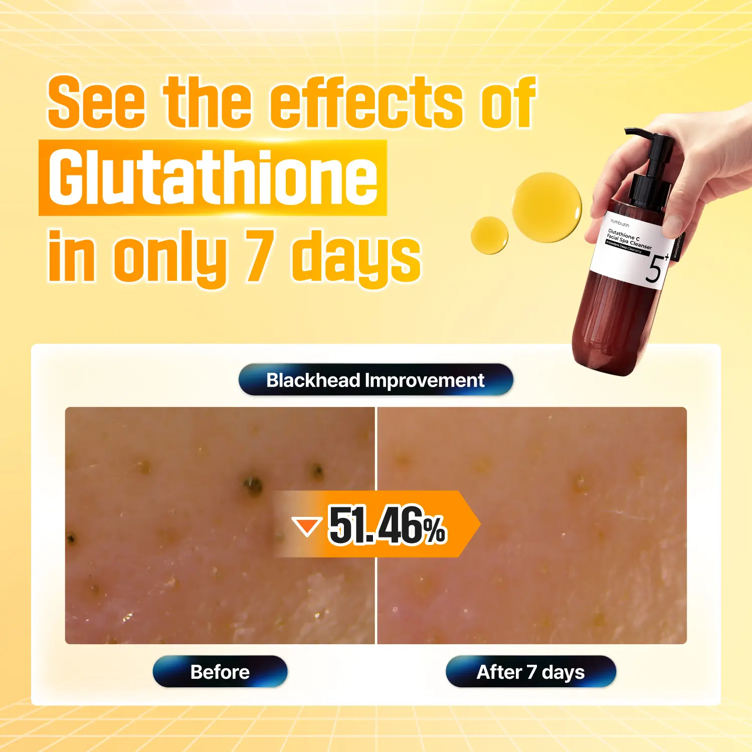 glutathion infusion Glutathione Infusion glutathion infusion Glutathione Infusion