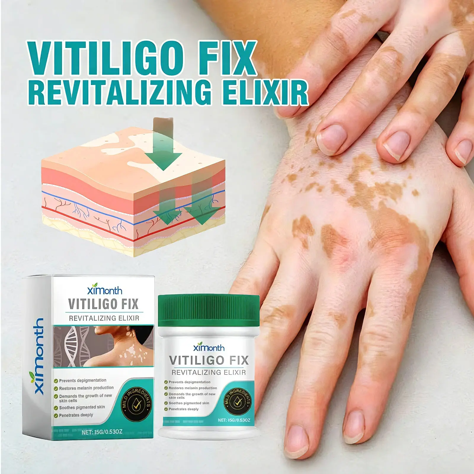 Vitiligo Care Cream to Help Restore Pigmentation and Reduce White Spots - Natural Plant-Based Body Care Moisturizer for All Skin Types Vitiligo Revitalizing Elixir;Vitiligo Cream;White Spot Treatment