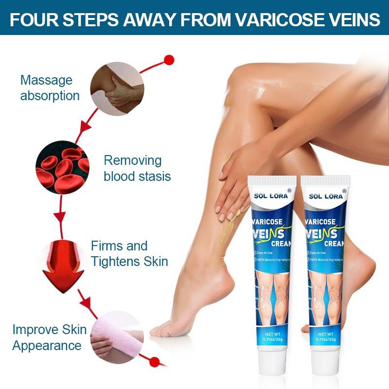 SOL LORA Varicose Veins Cream for Varicose Veins Relief of Bulging Blood Vessels in Legs - Hydrating Moisturizer for Smoother Skin & Improved Circulation
