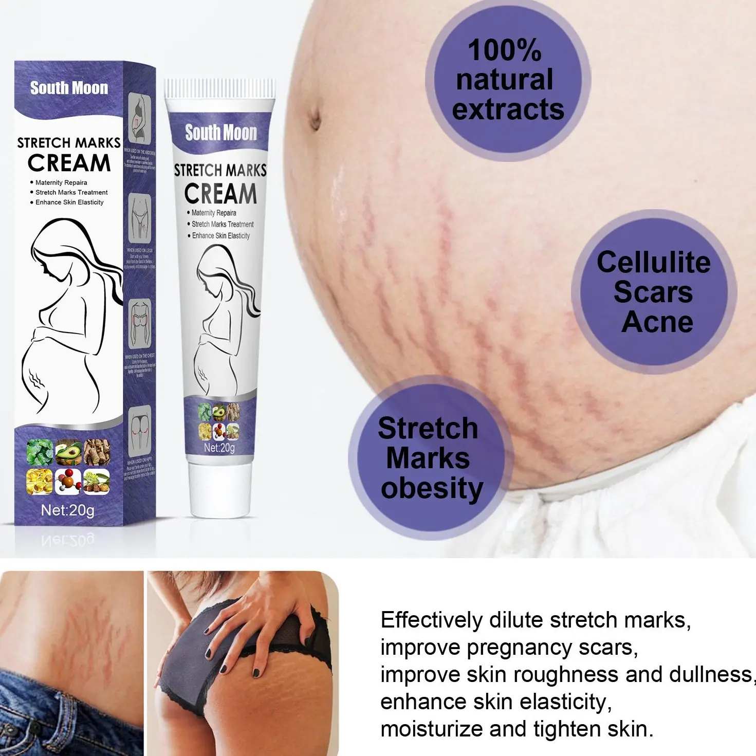 south moon Stretch Mark Cream, Reduces Marks and Fades Scars, Moisturizing Body Firming Treatment for Pregnancy Areas, 20g Single Tube, Elasticity, Firming/Lifting