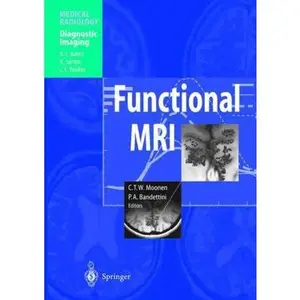 USED-Functional MRI (Medical Radiology) by P. A. Bandettini W. T. Moonen,C. T. Moonen (Paperback)