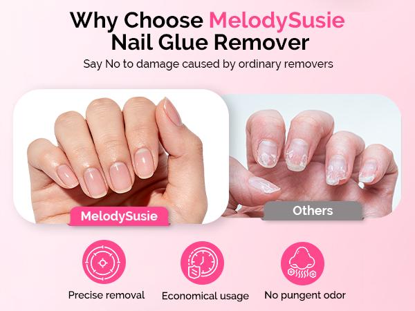MelodySusie 50ML Nail Glue Remover for Press on Nails, Acetone Free Nail Polish Remover Multi-Functional Remover for Acrylic Tips Gentle Glue Remover with Stick