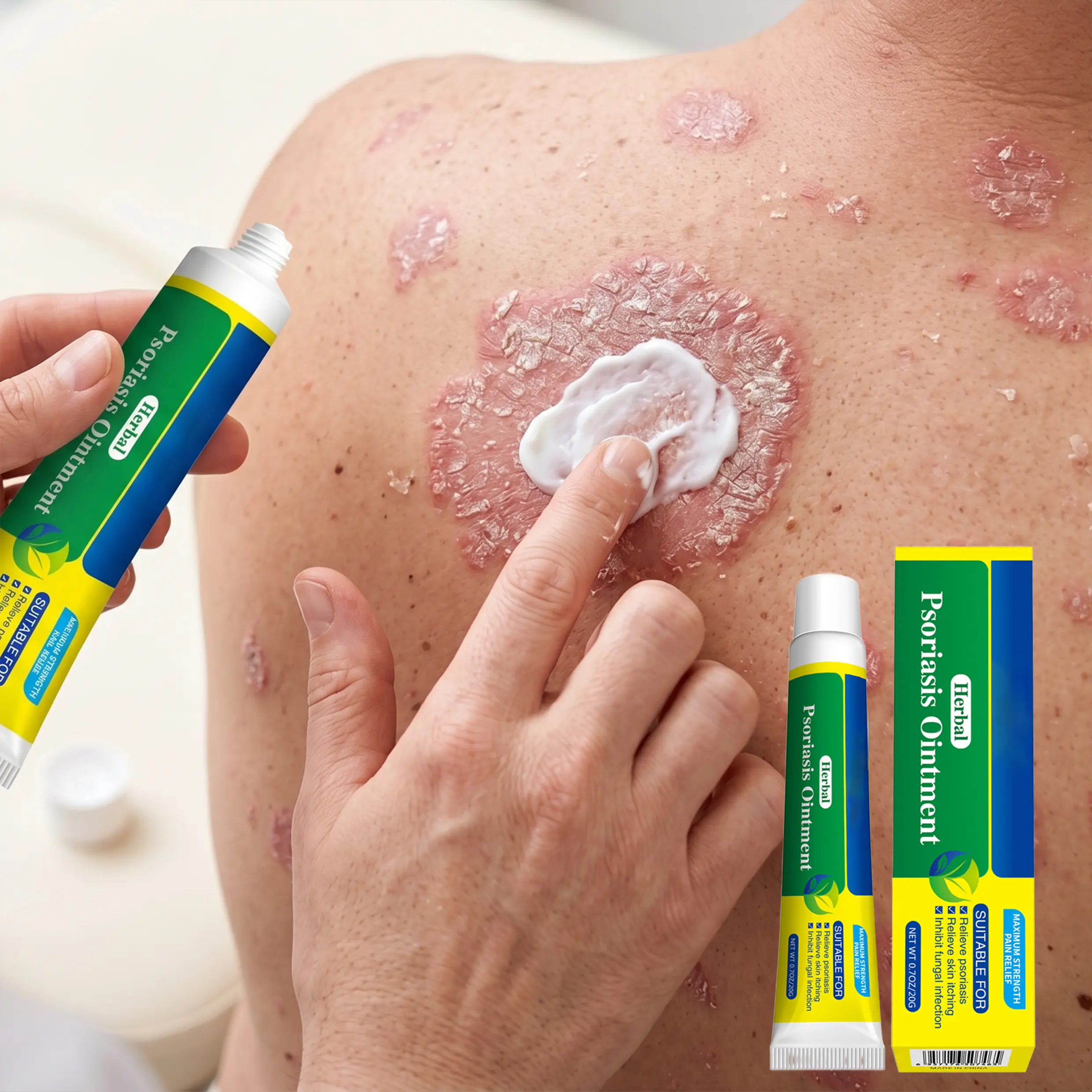 7 Day Sensitive Skin Relief Treatment Body Cream - Soothes Dry Itchy Skin, Psoriasis、 Eczema、 Herpes, Ringworm, Athlete's Foot, Jock ltch, Nail FungusTinea ,Yeast Infections, Seborrheic Dermatitis 、Repairs Dry Skin, 20g Lightweight Gentle