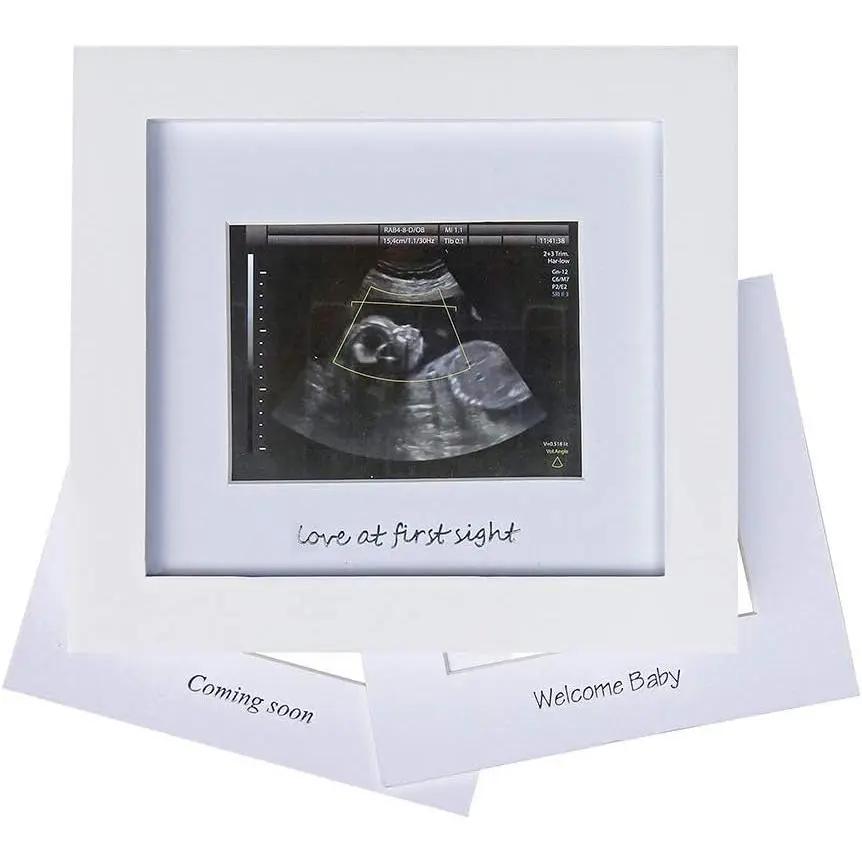 Classic Baby Sonogram Photo Frame - Silver Text, White Wood Border, Metallic Accent Home Decor Wall Frame for Nursery Room, Pregnancy Announcement Gift for Expecting Parents, Love at First Sight Baby Shower Present