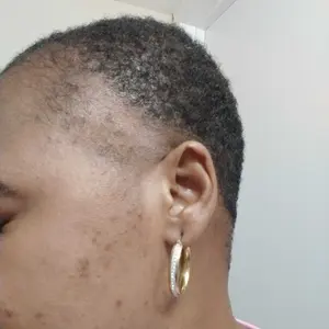 Kirkland Minoxidil 5% Extra Strength 1, 3, 6, 12 Months Supply Men Hair Regrowth (New Packaging)  Hair Care Comfort Serum