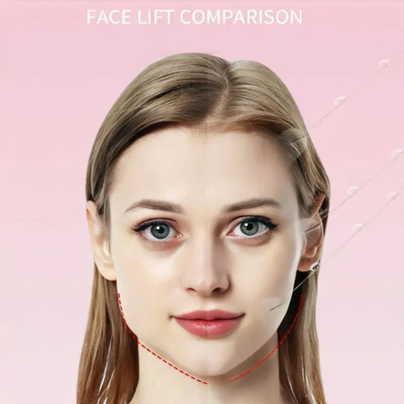 Face lifting patches, 2 boxes / 80 pieces Face lifting patches, 2 boxes / 80 pieces