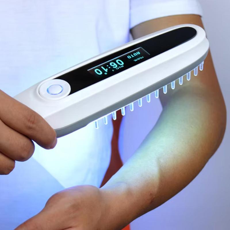 UVB 311nm Phototherapy Lamp Handheld Light Therapy Device for Vitiligo