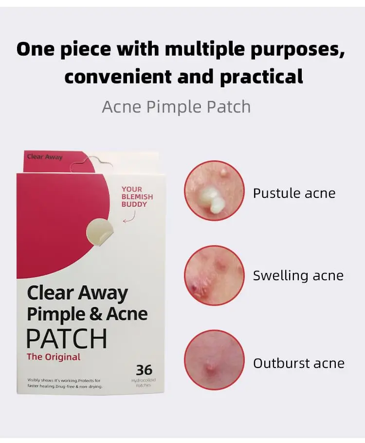 Clear Away Pimple & Acne Patch (36 Original Patches)   Pimple Patch for Covering Zits and Blemishes, Spot Stickers for Face  Skin Skincare Gentle Skin Hydrocolloid Pack